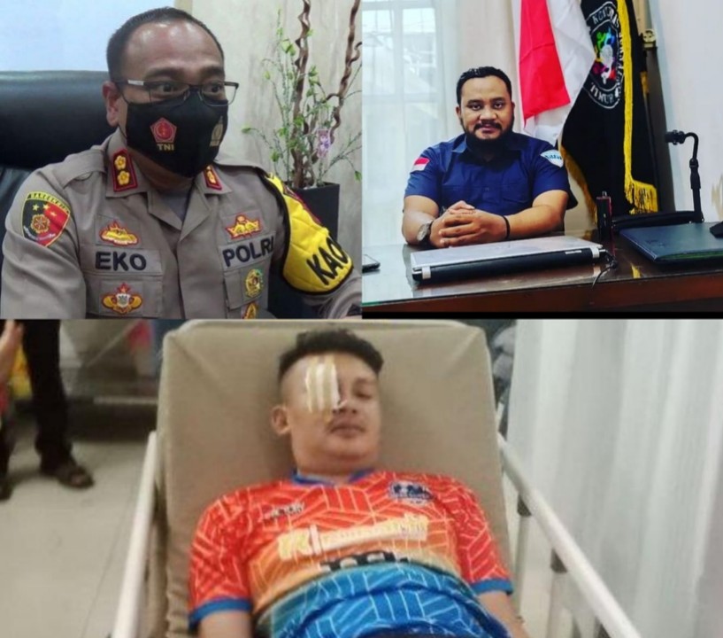 Kapolres Sumedang Merasa Malu Terkait Insiden Pemukulan Terhadap Husny Oleh Anggotanya